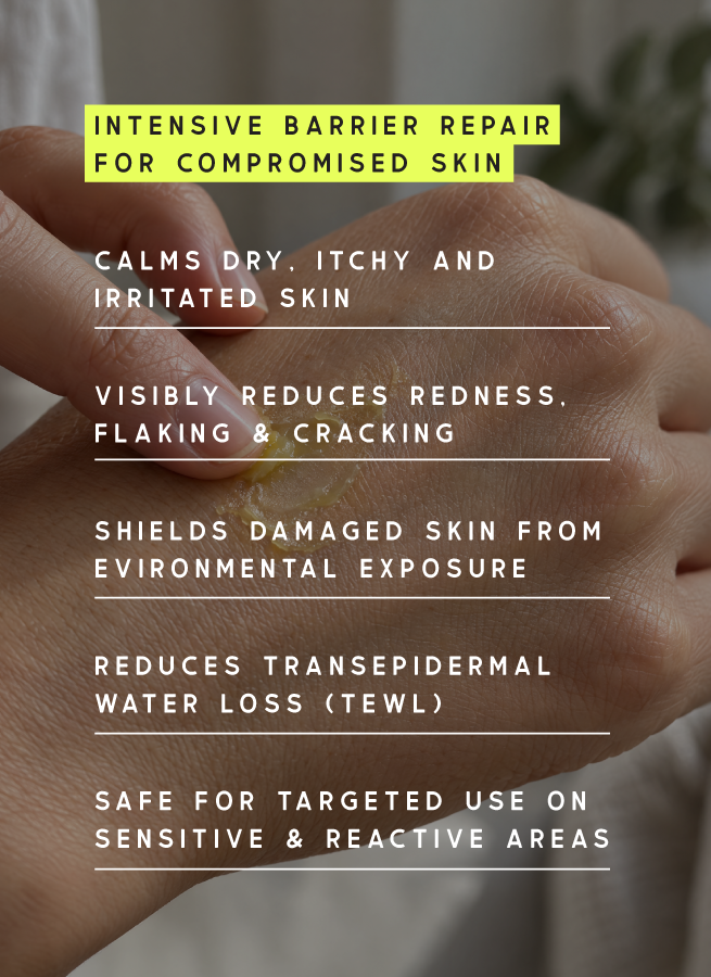 A close-up of a hand with a small amount of Formed Relief Balm on the back of the hand, overlaid with marketing text reading 'INTENSIVE BARRIER REPAIR FOR COMPROMISED SKIN' and additional benefit claims.